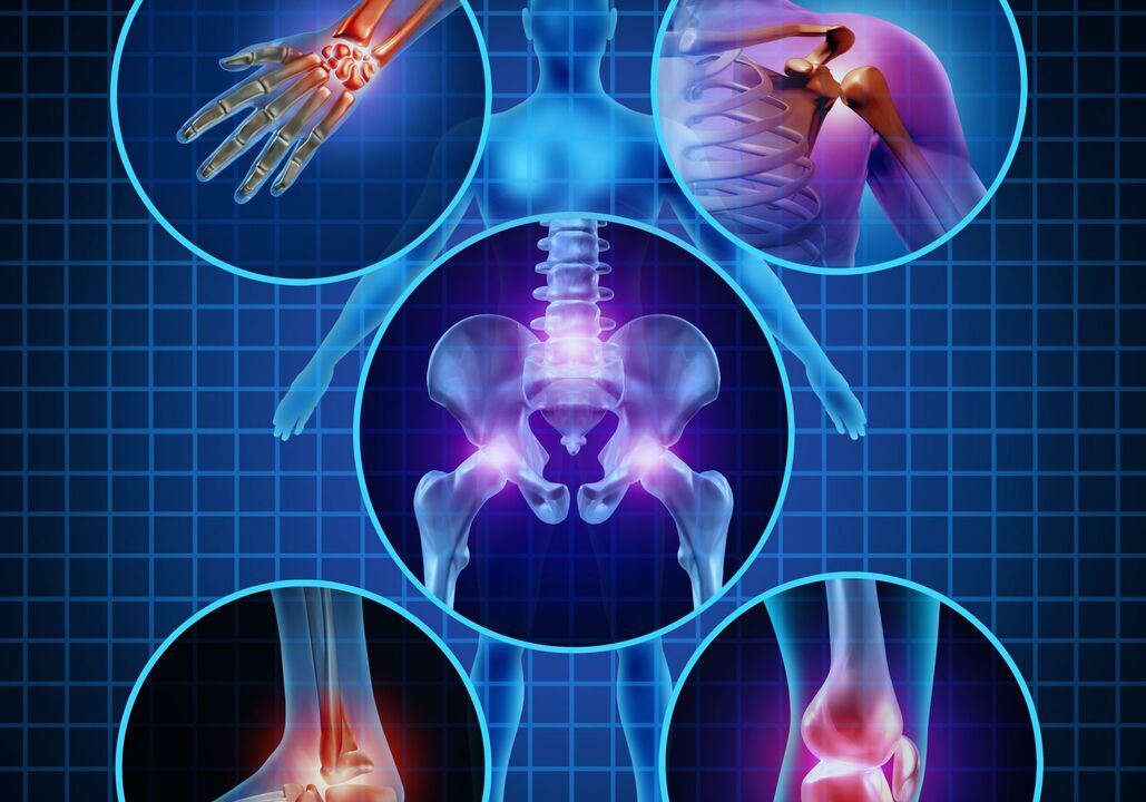 az arthrosis által érintett ízületek